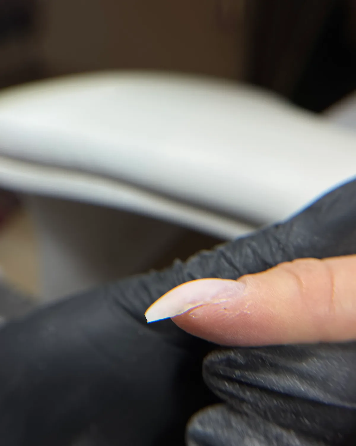 Ongle crochu vu de profil avant correction — la pointe plonge vers le bas, cabine Rendez-vous Belle Wasquehal