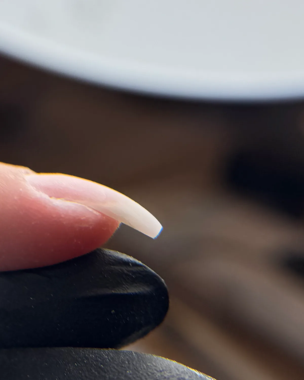 Second exemple : ongle crochu avant correction, vu de profil — Rendez-vous Belle Wasquehal